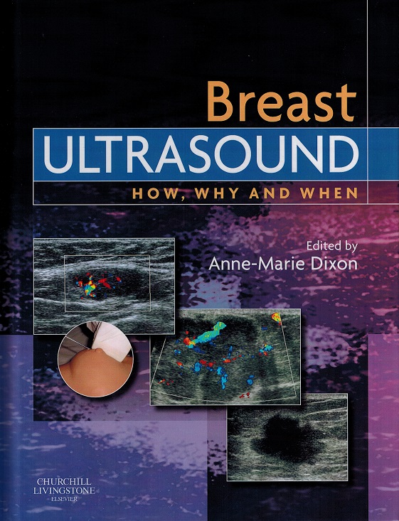 Breast　Lady　Ultrasound　X-Ray